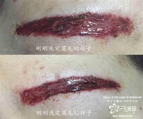 紋眉一點(diǎn)要慎重，別貪便宜，不然就是文中后果