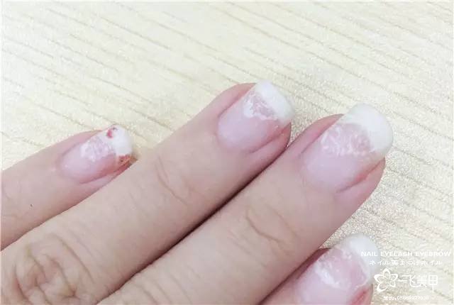 由于疫情的影響，不能營(yíng)業(yè)，推薦你們?cè)诩疫@樣卸美甲