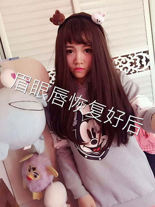 眉眼唇恢復(fù)好后