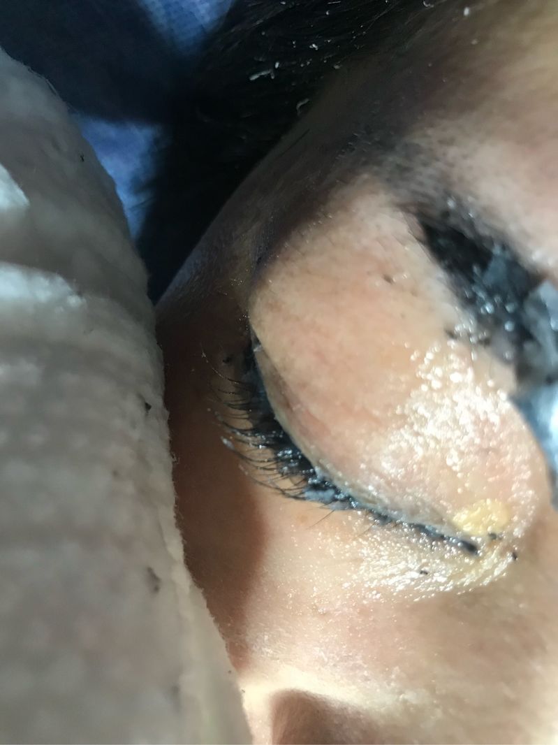 車禍現(xiàn)場，引以為戒！
