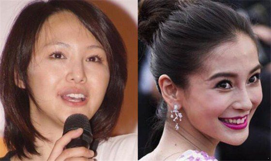 曾經(jīng)的甜心教主王心凌臉垮成這樣了，真替這5位女星捏把汗啊