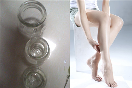 大腿拔罐的好處，，對(duì)身體有什么功效