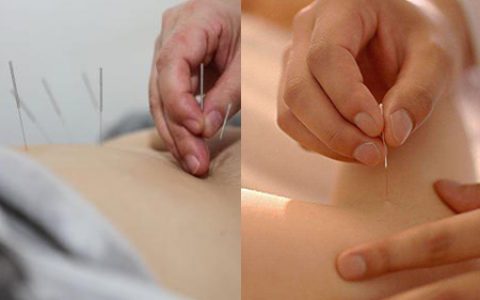 針灸減肥多久能瘦下來(lái)，了解這些很重要