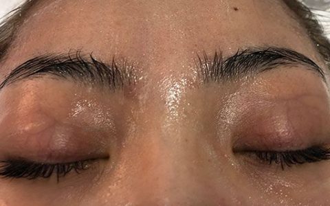 眼部皺紋能去掉么
