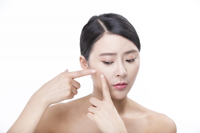 消除臉上痘痘，怎么去臉上痘痘簡單方法