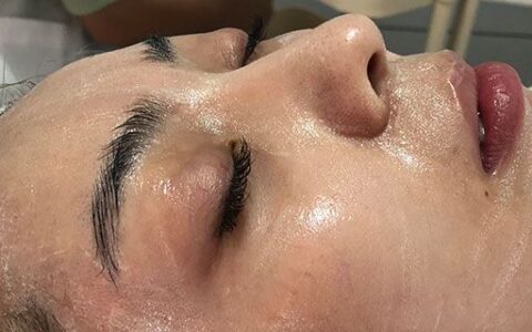 玻色因敏感肌膚能用嗎