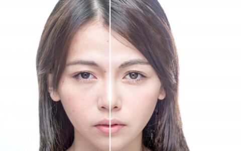 怎么清除痘痘，有效調(diào)理痘痘肌的方法