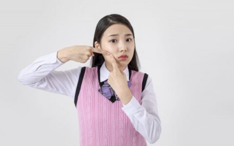 滿臉長痘痘怎么辦，日常怎么改善痘痘??？